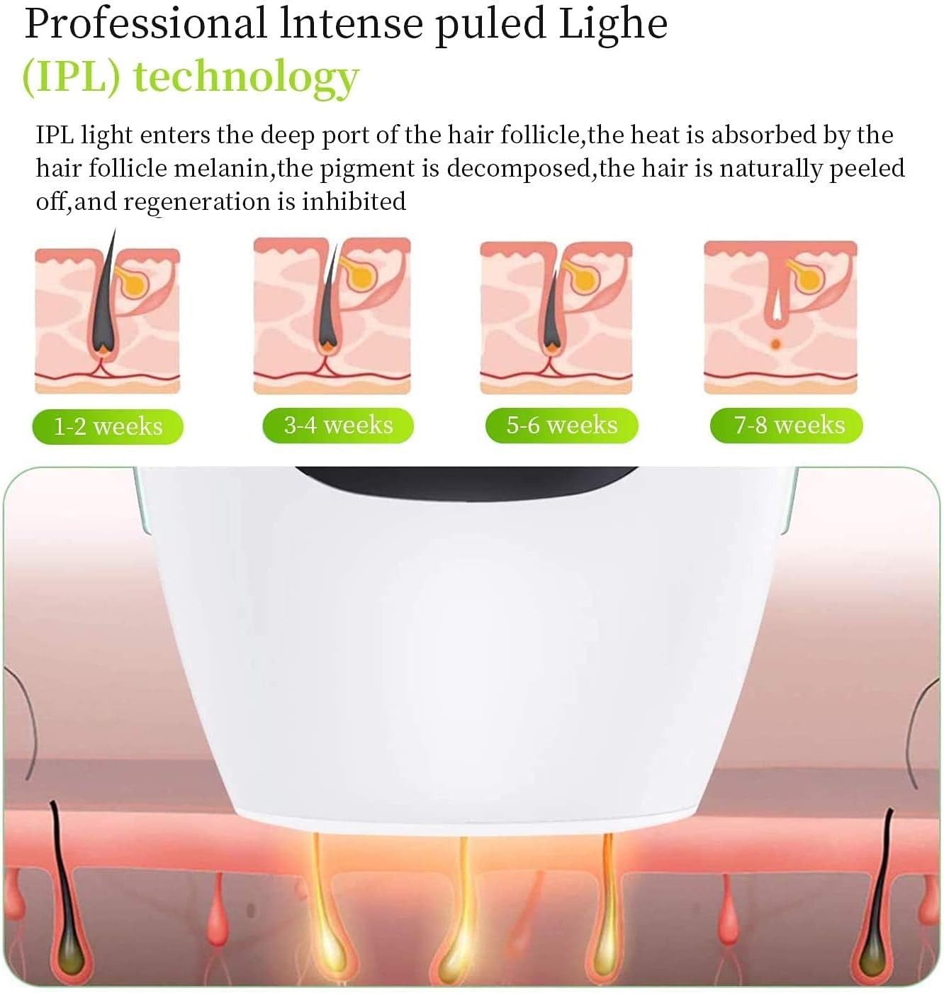 IPL Hair Removal System - My Store
